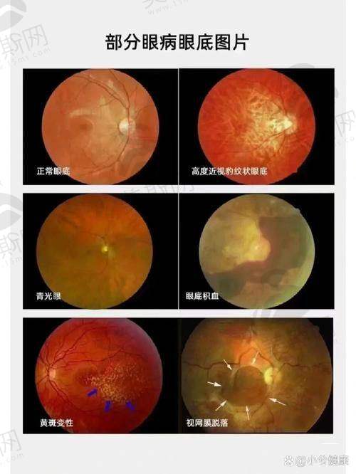 广东省人民医院眼科团队介绍