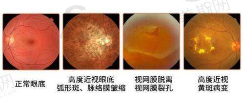 河南省人民医院眼科团队介绍