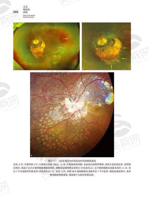 二、严素清医生擅长项目