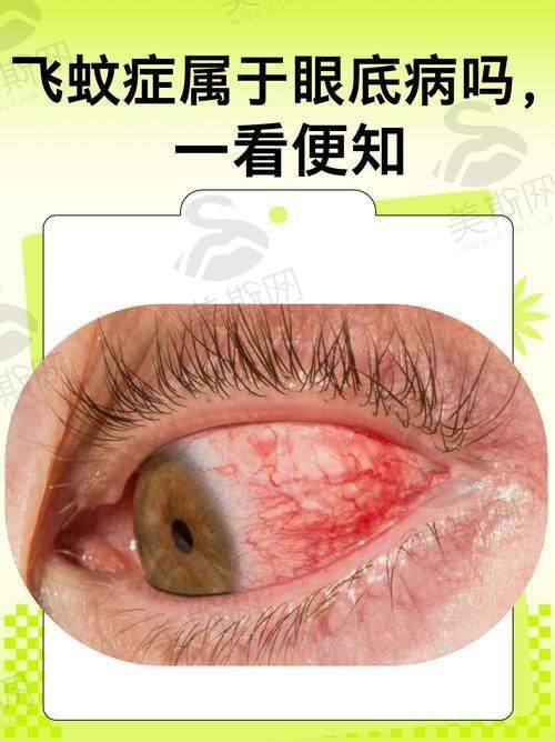 沈阳市于洪区人民医院眼科口碑如何