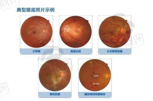 3、西安四院眼科是国有的吗?