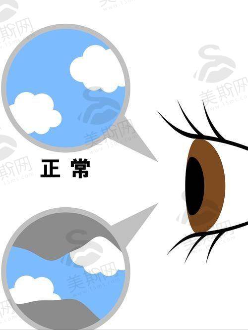 沈阳市第五人民医院眼科医院特色技术