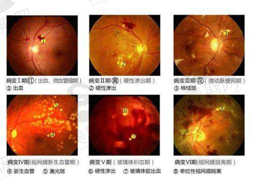 广州医 科 大学附属第一医院眼科怎么样?