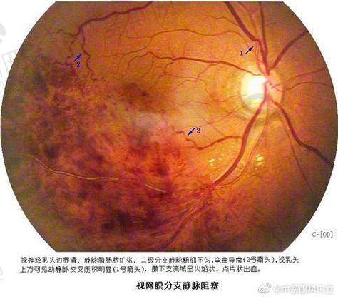 乔丽亚医生坐诊医院:北京熙仁眼科医院