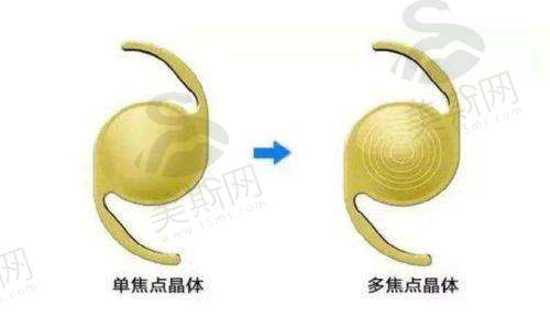 辽中区人民医院眼科诊疗项目