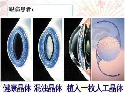 华中科技大学协和深圳医院眼科地址电话