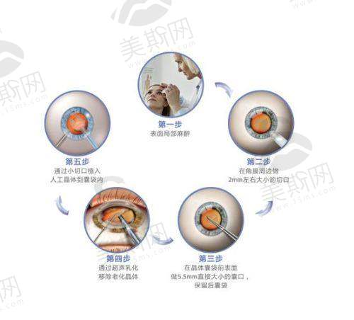 赵鹏飞医生技术水平高