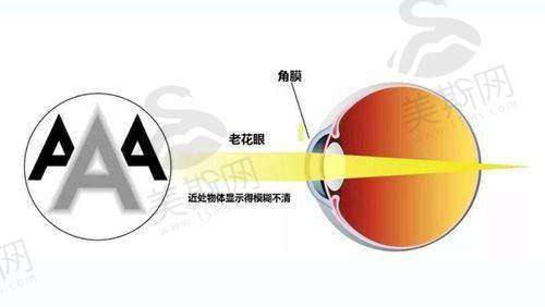 中山大学中山眼科中 心诊疗项目
