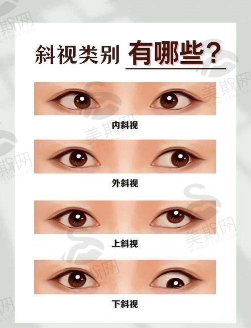 香港大学深圳医院眼科怎么样？