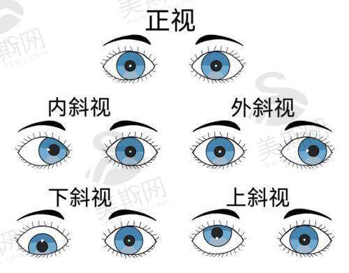 深圳市眼科医院预约挂号