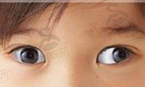 深圳市人民医院眼科正规吗?