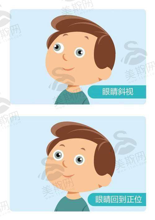 赣南医学校第一附属医院眼科特色技术