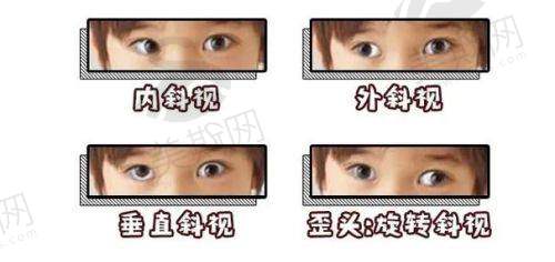北京同仁医院眼科正规吗?