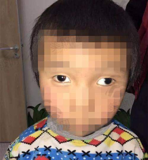 深圳市盐田区人民医院眼科特色技术
