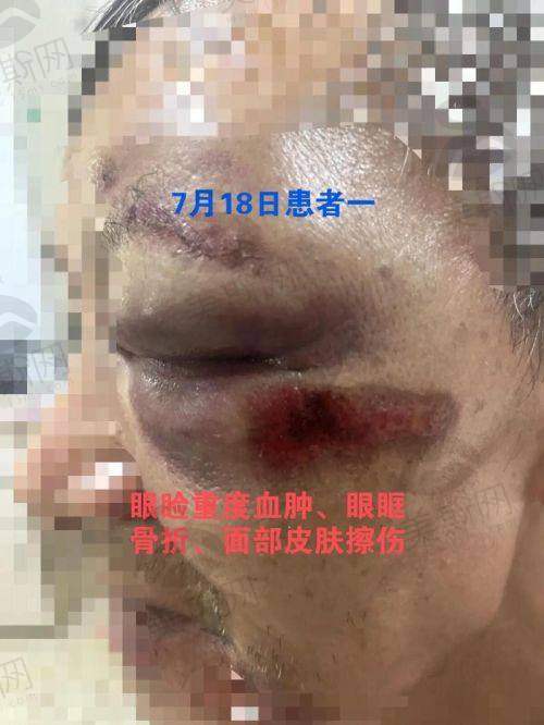中国医科大学附属第一医院大东医院眼科口碑如何