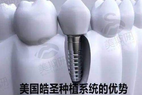 总结