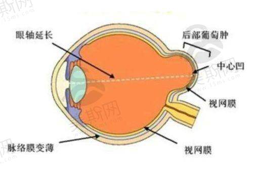 重庆西南医院眼科近视手术价格揭秘！含价格表，费用几千到上万，需预约吗？
