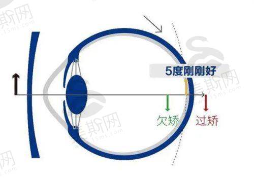 上海和平ophthalmic hospital就诊指南:从预约到取镜的全周期服务流程