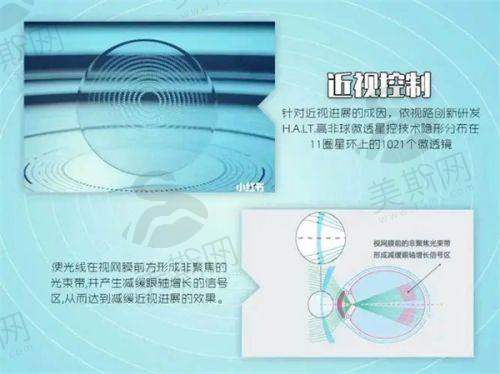 重庆西 南医院眼科近视手术价格
