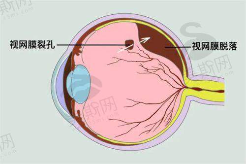 王红眼科医生国内排名