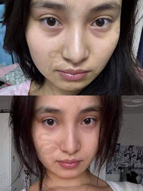 总结