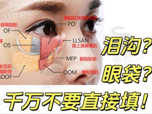 郑楚蓉