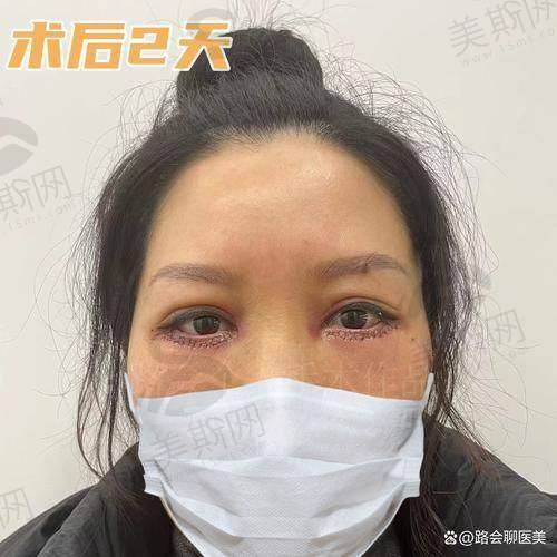 齐永乐
