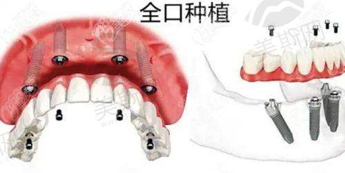成都橙奕口腔医院正规吗？