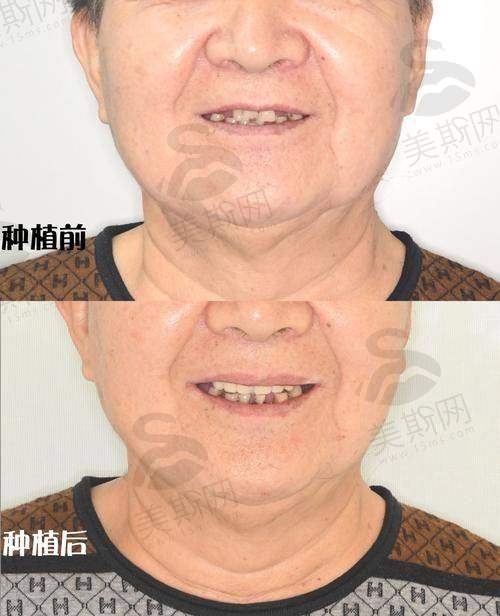 胡秀莲医生口碑评价及反馈内容