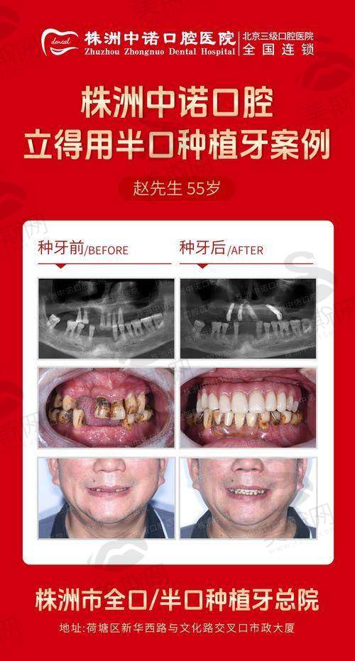 江西赣州唯乐口腔医院预约挂号