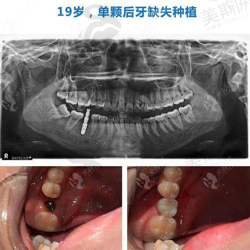 任抒欣医生执医荣誉