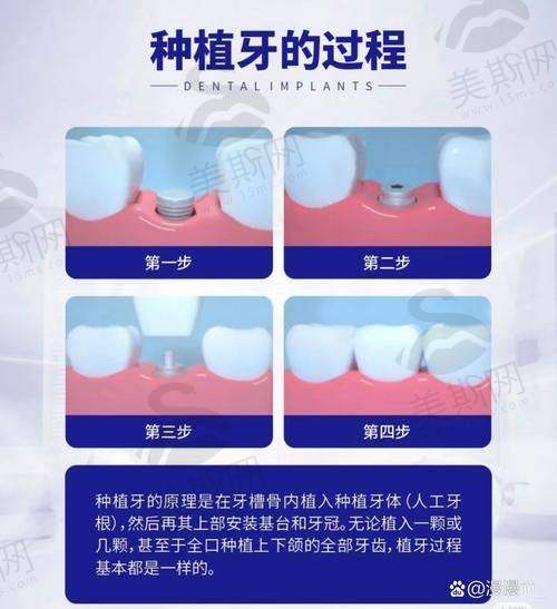 广东广州柏德口腔(海珠院区)团队介绍
