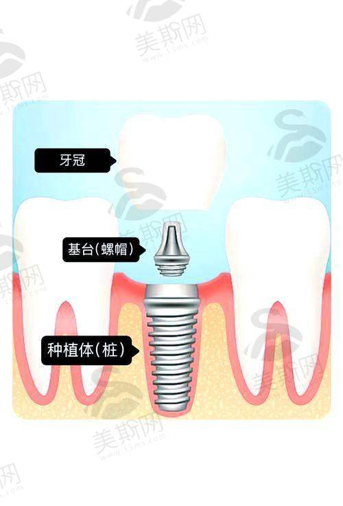 济南可恩口腔医院预约挂号