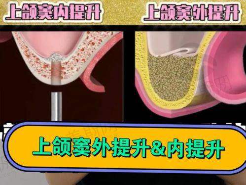 王非医生口碑评价及反馈内容