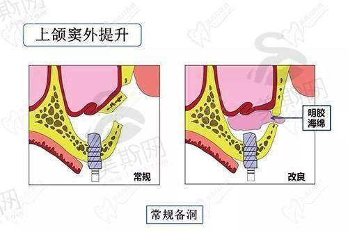 欧阳思远医生坐诊医院