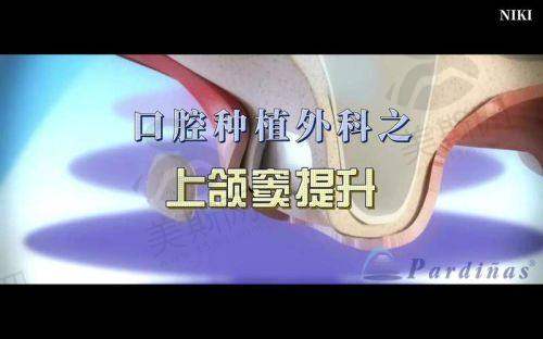 庄锐医生技术水平高