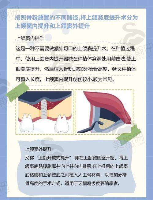 刘博闻医生擅长项目