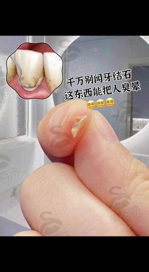 浙江绍兴越城麦芽口腔诊所诊疗项目
