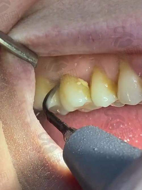 陕西汉中小虎牙口腔门诊部正规吗？