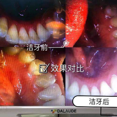 安徽池州安美口腔门诊部院价格表