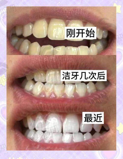 云南玉溪牙博仕口腔医院是国有的吗？