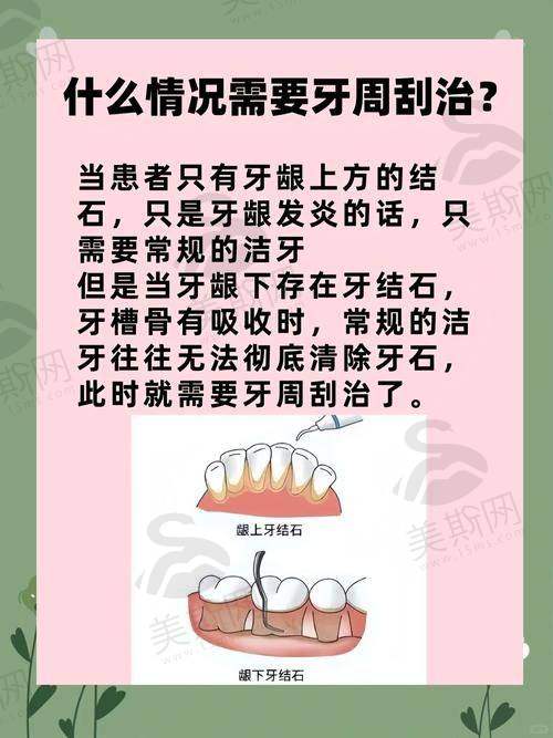 实例1:重度牙周炎患者的“重生”