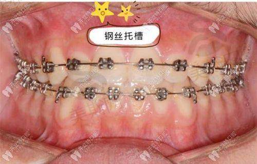 李晓梅医生个人简介