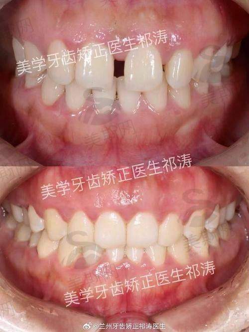 山东烟台壹颗芽口腔门诊部(润邦集团)口碑如何