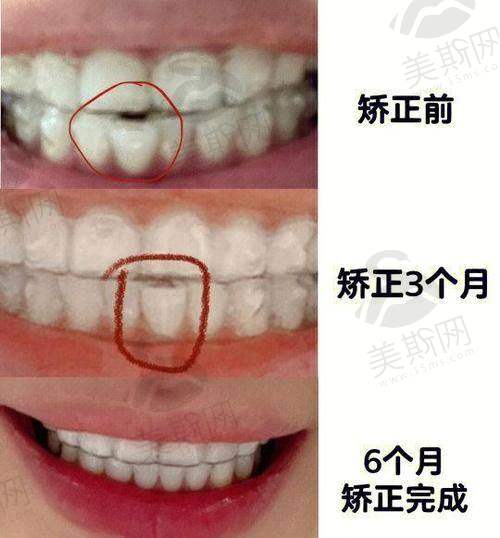 大连甘井子康贝佳口腔门诊部正规吗?