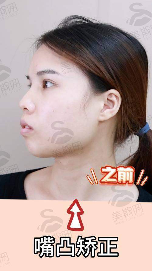 周传丽医生擅长项目