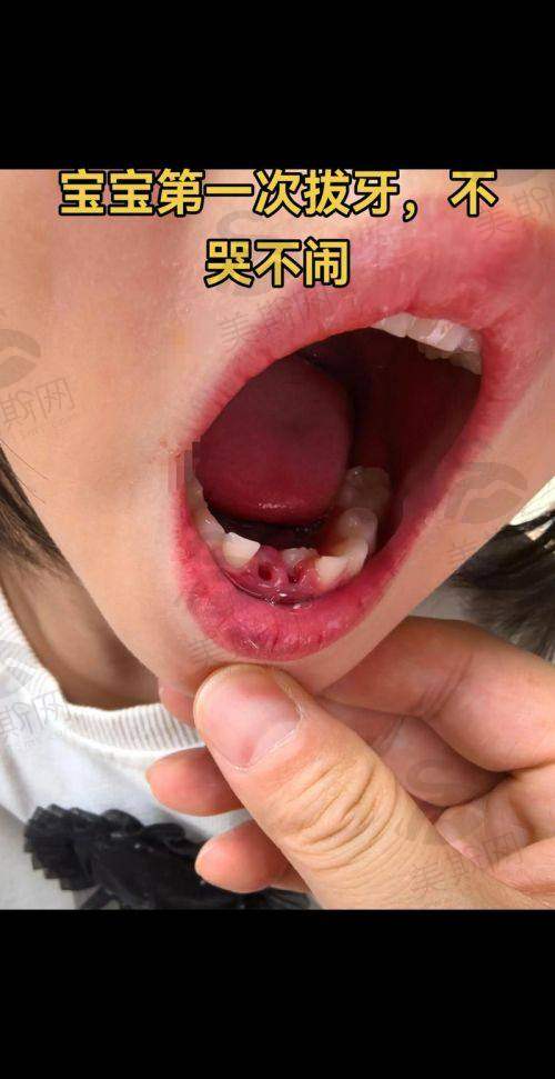 广西 南宁诺贝尔口腔门诊（市立口腔）口碑如何