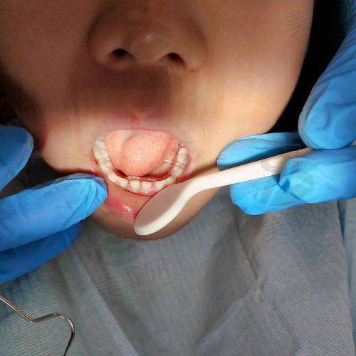 广东广州柏德口腔(海珠院区)口碑如何