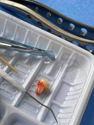深圳爱康健口腔医院价格表