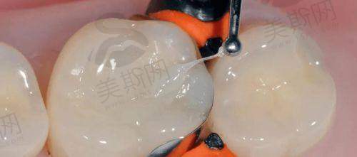 青海西宁中诺口腔医院正规吗？